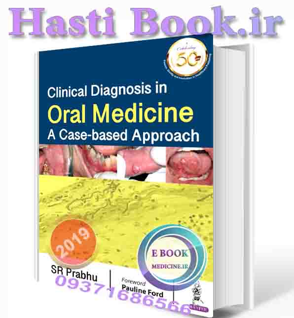 دانلود کتاب CLINICAL DIAGNOSIS IN ORAL MEDICINE: A CASE-BASED APPROACH 2020  (ORIGINAL PDF)  